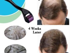 Microneedle Derma Roller 0.5mm – Boost Collagen & Hair Regrowth Naturally